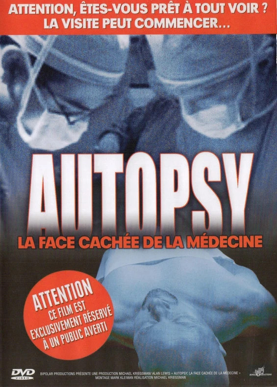 DVD Autopsy - La Face Cachée de la Médecine - doc mc93 1