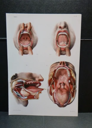 Planche Anatomique Corps humain Chirurgie Médecine Cabinet de curiosité 23x33cm, brand: Curiosité, condition: Very good, €7.49, €8.56 includes Buyer Protection